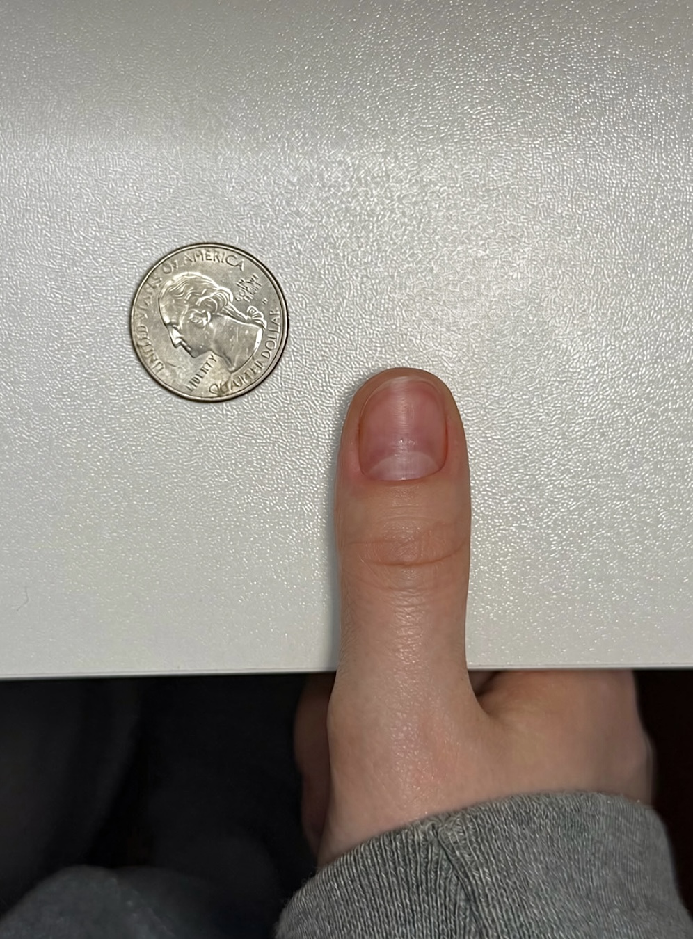 Example sizing photo showing a thumb nail beside a quarter